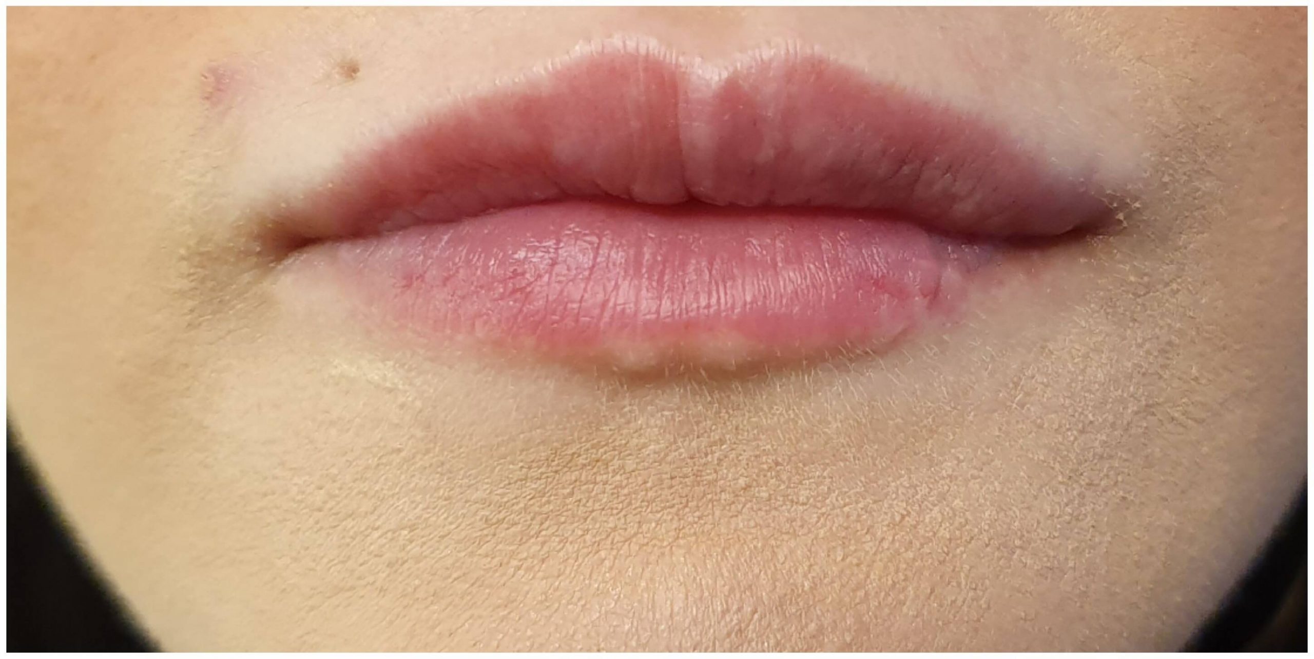 After-Juicy lips με απολυτα φυσικο αποτελεσμα
