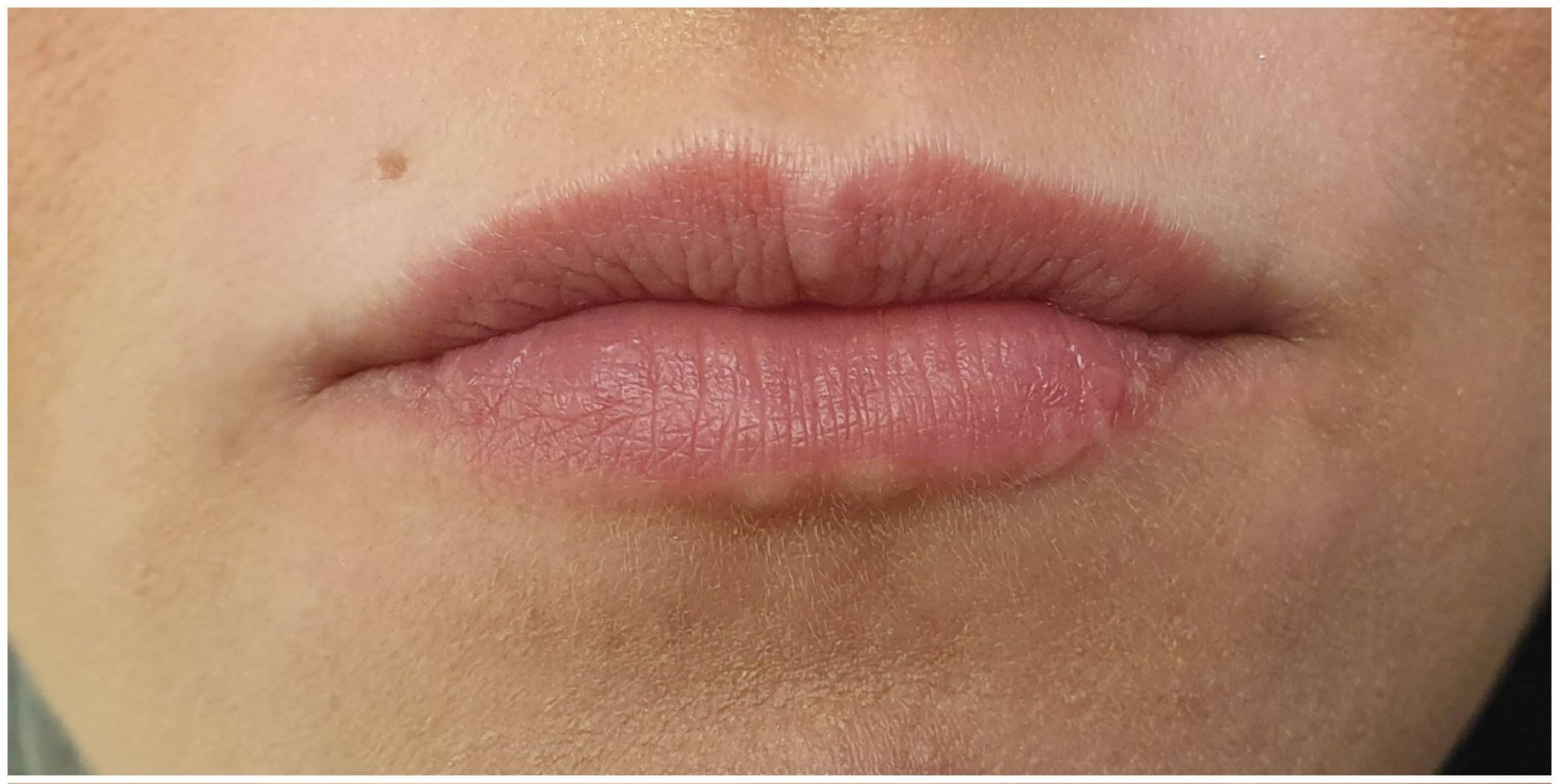 Before-Juicy lips με απολυτα φυσικο αποτελεσμα